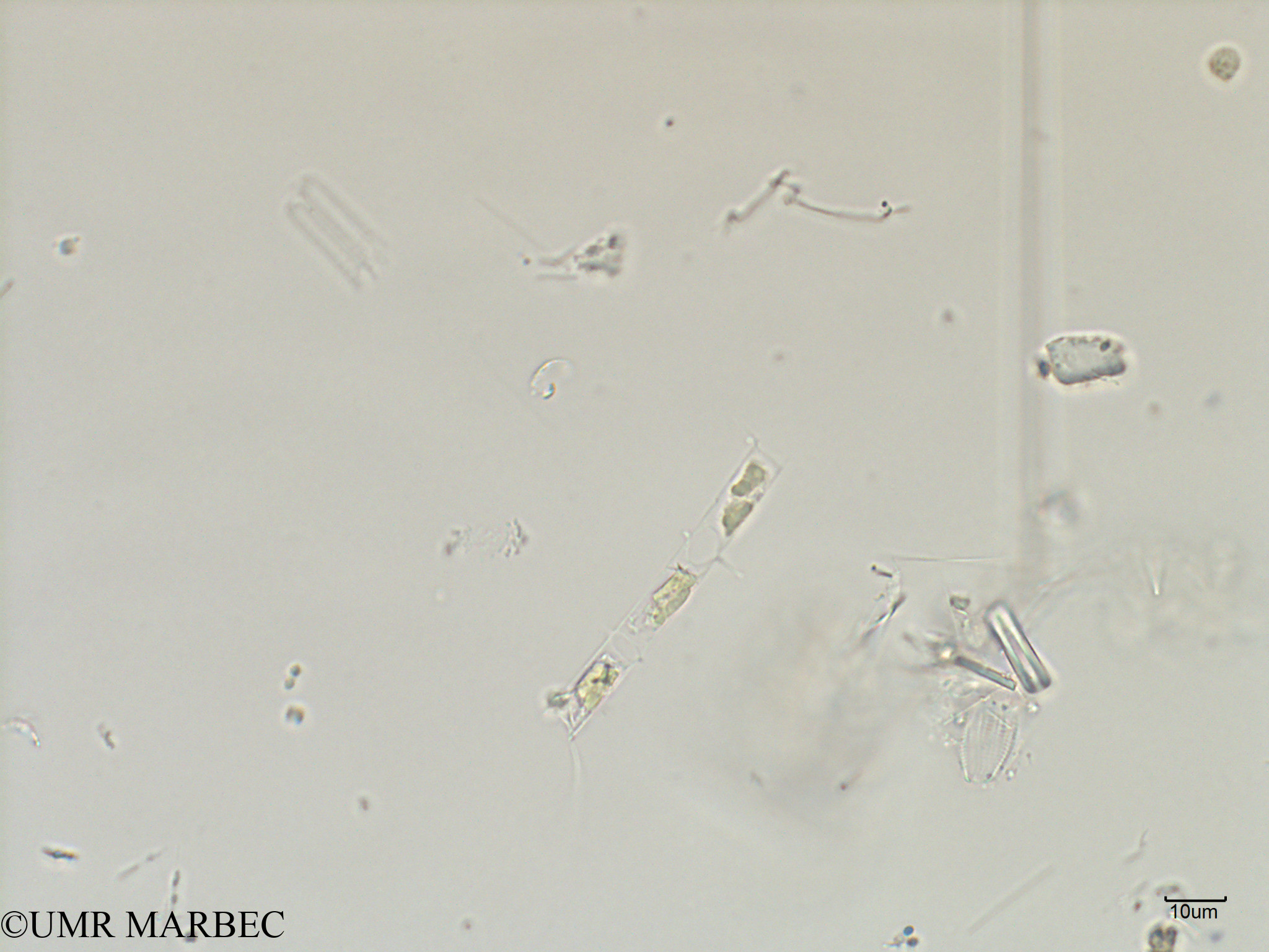 phyto/Scattered_Islands/iles_glorieuses/SIREME May 2016/Chaetoceros sp44 (ancien Chaetoceros sp12 -SIREME-Glorieuses2016-GLO6surf-271016-Chaetoceros-6)(copy).jpg